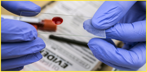 a pair of gloved hands hold a small glass specimen plate with a drop of blood on it