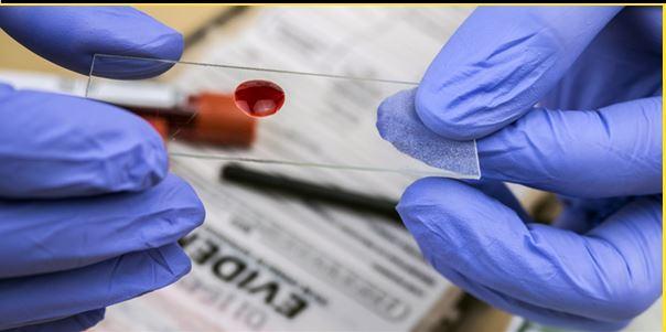 Drop of blood on a slide