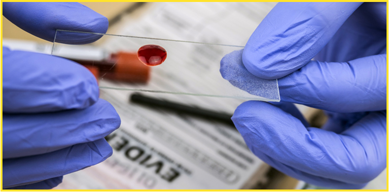 a pair of gloved hands hold a small glass specimen plate with a drop of blood on it